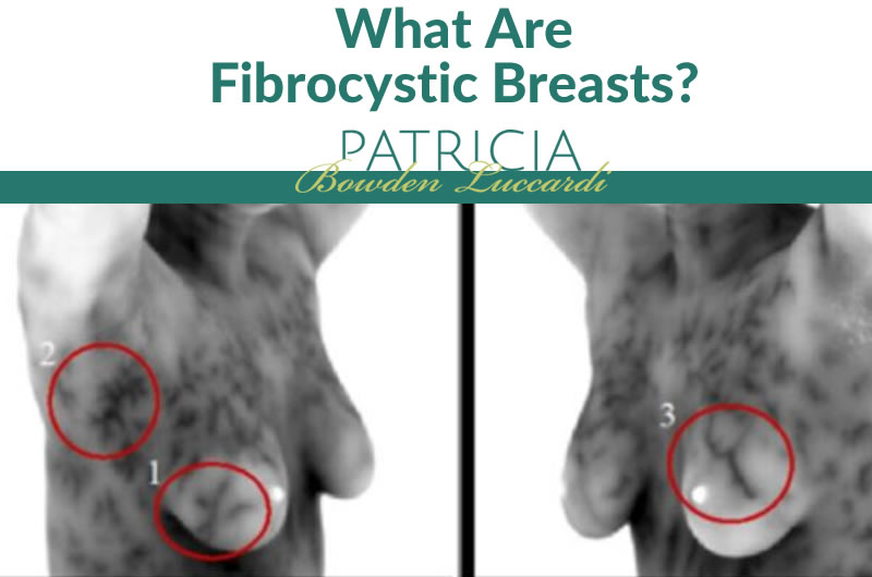 fibrocystic breast changes lumps that are normal