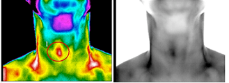 thermography imagery