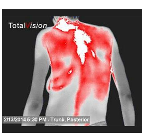thermography imagery